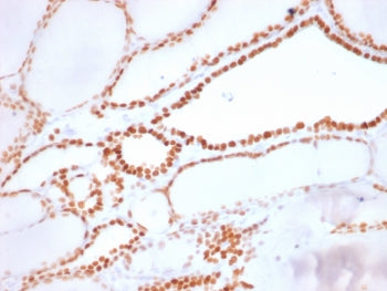 IHC: Formalin-fixed, paraffin-embedded human thyroid stained with recombinant NKX2.1 antibody (clone