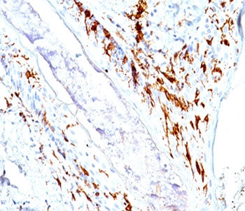CD1a Antibody Cocktail
