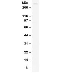 APOB Antibody