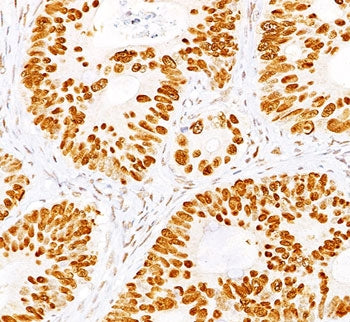 p53 Antibody Cocktail / TP53