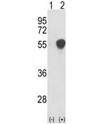 Western blot analysis of PHGDH antibody and 293 cell lysate either nontransfected (Lane 1) or transi