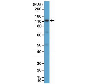 Western blot testing of human K562 cell lysate with recombinant CD30 antibody at 1:1000 dilution. Ex