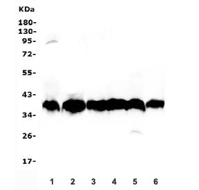 Aldolase B Antibody / ALDOB