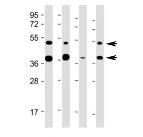 Western blot testing of FDPS antibody at 1:2000: Lane 1) human HeLa, 2) (h) HepG2, 3) (h) U-251 MG a