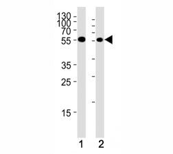 Chk1 antibody western blot analysis in (1) HeLa cell line and (2) mouse thymus tissue lysate. Predic