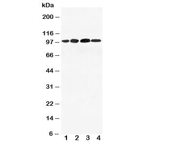 Western blot testing of Mineralocorticoid Receptor antibody and Lane 1: 293T; 2: SMMC-7721; 3: SW620