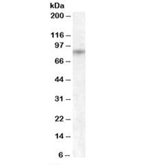 Western blot testing of human pancreas lysate with TRPV5 antibody at 1ug/ml. Predicted/observed mole