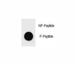 Dot blot analysis of phospho-c-Kit antibody. 50ng of phos-peptide or nonphos-peptide per dot were sp