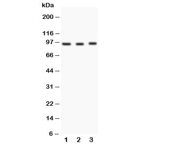 Western blot testing of FER antibody and Lane 1: HeLa; 2: rat testis; 3: rat ovary. Predicted/observ