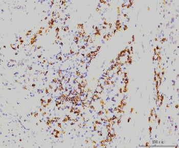 RAB11A Antibody