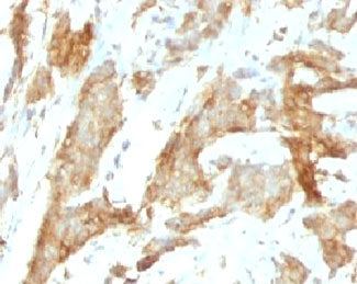 GRP94 Antibody / HSP90B1
