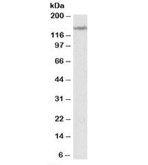 Western blot testing of human cerebellum lysate with LMTK2 antibody at 2ug/ml. Predicted molecular w