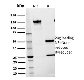 SDS-PAGE analysis of purified, BSA-free ICAM1 antibody (clone 15.2) as confirmation of integrity and