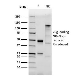 TLR2 Antibody