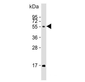 Western blot testing of human HeLa cell lysate with FUT6 antibody. Predicted molecular weight ~42 kD