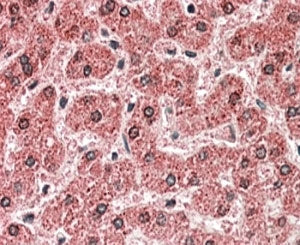 MPV17 Antibody