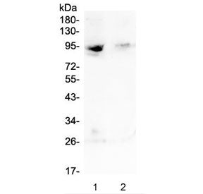 Western blot testing of human 1) MDA-MB-231 and 2) Jurkat lysate with RASAL1 antibody at 0.5ug/ml. P