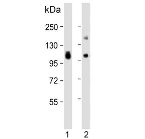 Western blot testing of human 1) lung and 2) liver lysate with VAP-1 antibody. Predicted molecular w