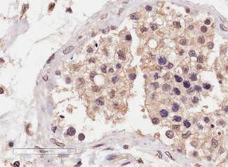 IHC testing of FFPE human testis tissue with SLC22A16 antibody at 4ug/ml. HIER: steamed with pH9 Tri