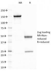 CELA3B Antibody / Elastase 3B
