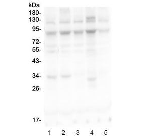 Western blot testing of human 1) HEK293, 2) HeLa, 3) COLO320, 4) T-47D and 5) A549 cell lysate with 