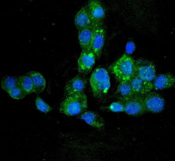 Immunofluorescent staining of FFPE human A431 cells with HYI antibody (green) and DAPI nuclear stain