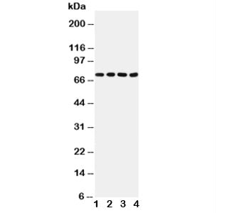 Western blot testing of Tau antibody and Lane 1: rat brain (40ug); 2: rat brain (50ug); 3: mouse bra