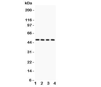Alpha 1 Antitrypsin Antibody