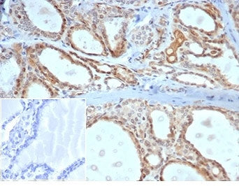 IHC staining of FFPE human thyroid tissue with Daxx antibody (clone PCRP-DAXX-5G11) at 2ug/ml. Negat