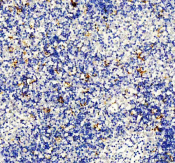 IHC staining of FFPE human spleen tissue with DC-SIGN antibody, HRP-secondary and DAB substrate. HIE