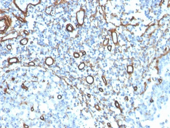IHC staining of FFPE human tonsil with recombinant Collagen IV antibody. HIER: boil tissue sections 