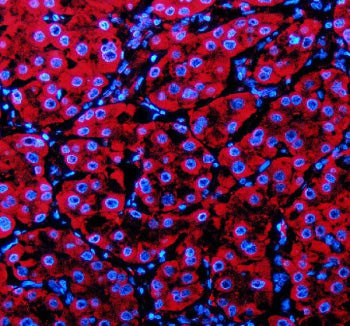 Immunofluorescent staining of PECR using anti-PECR antibody (red). PECR was detected in a paraffin-e
