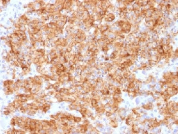 Chromogranin A Antibody