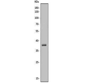 Western blot testing of human HEK293 cell lysate with CA10 antibody. Predicted molecular weight ~38 