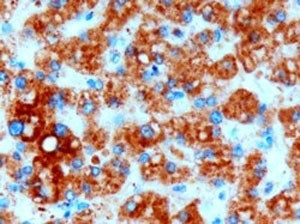 IHC testing of FFPE human liver with DGAT2 antibody at 3ug/ml. HIER: microwave with pH9 Tris/EDTA bu