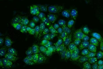 Immunofluorescent staining of FFPE human MCF7 cells with TBX4 antibody (green) and DAPI nuclear stai