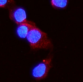 ACVR2A Antibody