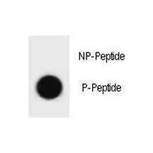 Dot blot analysis of phospho-IKKB antibody. 50ng of phos-peptide or nonphos-peptide per dot were spo