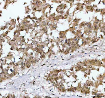Immunohistochemical staining of NR1D2 using anti-NR1D2 antibody. NR1D2 was detected in a paraffin-em