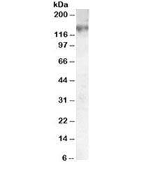 Western blot testing of A549 lysate with ABCC1 antibody at 0.05ug/ml. Predicted molecular weight: 15