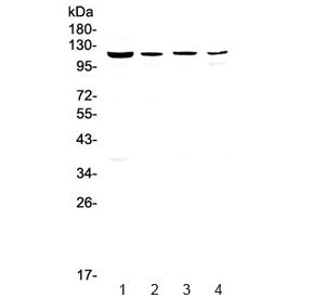 Western blot testing of rat 1) liver, 2) kidney, 3) brain and 4) heart lysate with RPGR antibody at 