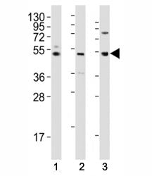 Western blot testing of LAG3 antibody at 1:2000 dilution tested on human lysates, Lane 1: K562; 2: l