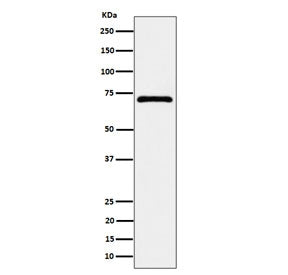 Western blot testing of human MCF7 cell lysate with Epoxide hydrolase 2 antibody. Predicted molecula