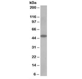 Western blot testing of human muscle lysate with OSBPL1A antibody at 0.5ug/ml. Predicted/observed mo