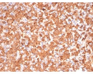 IHC staining of FFPE dog liver tissue with PRKCI antibody (clone PRKCI/4911). HIER: boil tissue sect