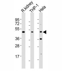 BMP2 Antibody