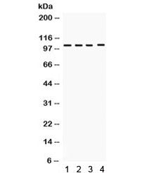 Western blot testing of 1) rat spleen, 2) rat thymus, 3) human placenta and 4) HeLa lysate with HDAC