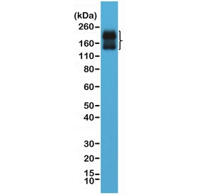 Western blot testing of human brain lysate with recombinant CD56 antibody at 1:2000 dilution. Predic
