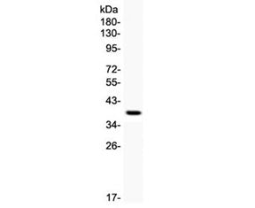 KIM-1 Antibody / TIM-1 / HAVCR1