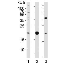 Western blot testing of human 1) A549, 2) HepG2 and 3) U-87 MG cell lysate with Epiregulin antibody.